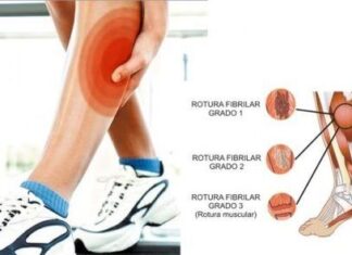 Una Contractura puede Ocasionar un Desgarro Muscular Contractura y Roturas Musculares