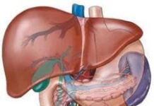 Hepatitis