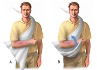 ¿Cómo hacer un CABESTRILLO para Hombro y Brazo?