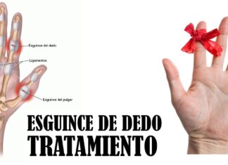 Esguince del DEDO de la mano: Tratamiento y cómo evitar el dolor Esguince del DEDO de la mano: Tratamiento y cómo evitar el dolor