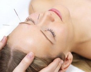 Acupuntura para Dejar de Fumar