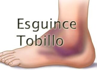 Tipos de Esguinces de Tobillo y… ¿Cómo CURAR tu esguince? tipos de esguinces de tobillo