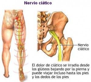 Nervio Ciático