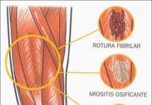 Micro-rotura fibrilar