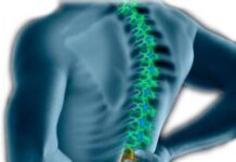 Cómo ayudar a minimizar el dolor de espalda