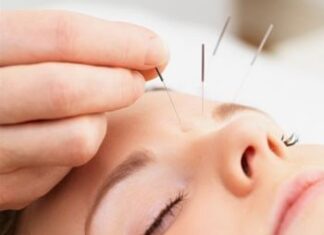 ¿Porqué utilizar la acupuntura?