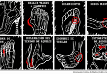 Lugares donde suceden las lesiones más frecuentes