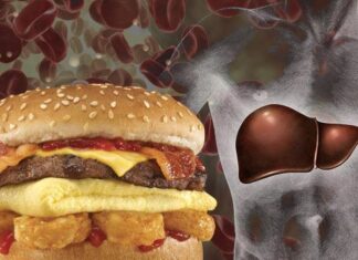 Todo lo que se debe conocer sobre la salud del hígado