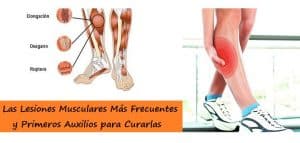 Lesiones Musculares Más Frecuentes y su Tratamiento
