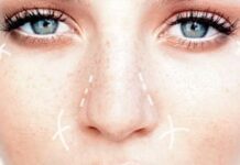 Consejos a tener en cuenta antes de una cirugía cosmética