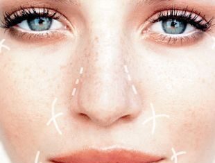 Consejos a tener en cuenta antes de una cirugía cosmética