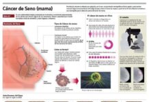 El Cáncer de Mama. Información completa
