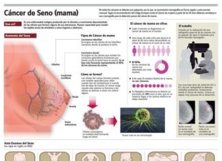 El Cáncer de Mama. Información completa