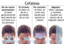 Dolor de Cabeza. Cómo prevenirlo.