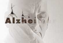 Síntomas del alzeimer