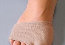 Sobre el juanete (Hallux valgus) y tratamientos iniciales