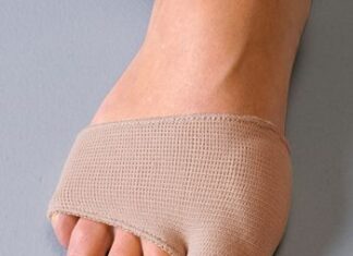 Sobre el juanete (Hallux valgus) y tratamientos iniciales