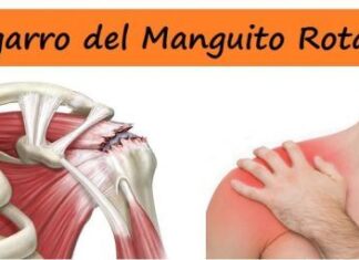 Desgarro o ROTURA del MANGUITO ROTADOR ¡Causas, Síntomas y Tratamiento! Desgarro del Manguito Rotador