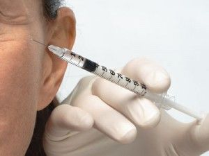 tratamiento con botox