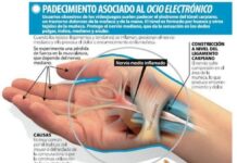 El Dolor de Muñeca puede ser debido al Síndrome del Túnel Carpiano
