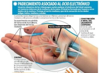 El Dolor de Muñeca puede ser debido al Síndrome del Túnel Carpiano
