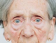 No Poder Detectar el Sarcasmo puede ser un Síntoma de Demencia