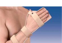 Tratamiento de la Fractura de Mano