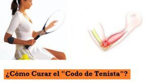 ¿Cómo curar el codo de tenista o epicondilitis?