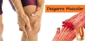 Desgarro Muscular
