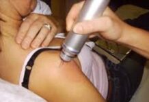 Ondas de choque en fisioterapia