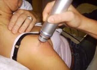 Ondas de choque en fisioterapia