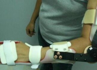Terapia alternativa: ortesis