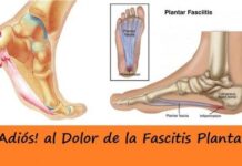 FASCITIS Plantar ¿Qué es? y EJERCICIOS para EVITAR el DOLOR tratamiento fascitis plantar
