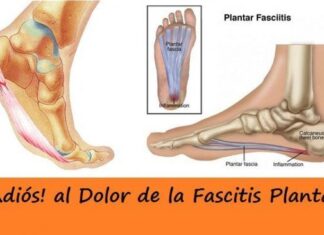 FASCITIS Plantar ¿Qué es? y EJERCICIOS para EVITAR el DOLOR tratamiento fascitis plantar