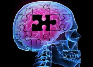 Cómo Estimular la Mente de un Enfermo de Alzheimer Cómo Estimular la Mente de un Enfermo de Alzheimer