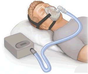 Aparatos para una correcta fisioterapia respiratoria 