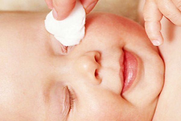 CONJUNTIVITIS Sus Síntomas y Tratamiento