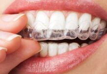 ¿Tu Padeces de BRUXISMO?