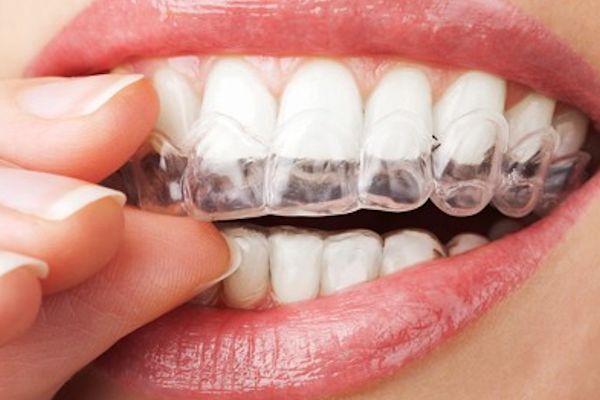 Tu Padeces de BRUXISMO