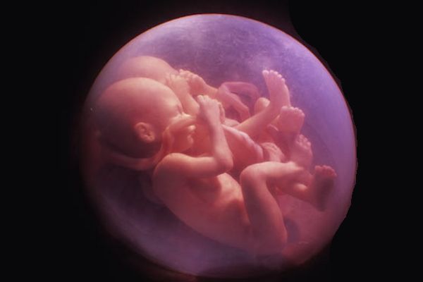 Embarazos Múltiples parte I.docx