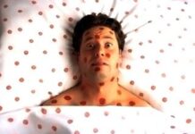 Aumento del sarampión