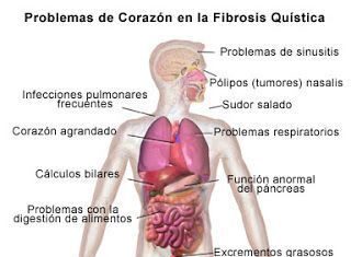 Desarrollo de la fibrosis quística