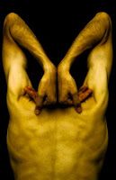 Bursitis