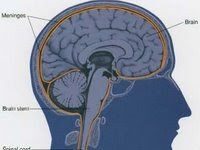 Meningitis