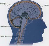 Meningitis