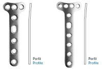 Revestimiento de fracturas: 2ª parte