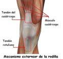 Análisis biomecánico de la rodilla en el gesto de ataque en el voleibol en un deportista con tendinitis patelar