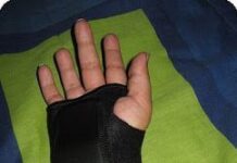 La Tendinitis y su Tratamiento