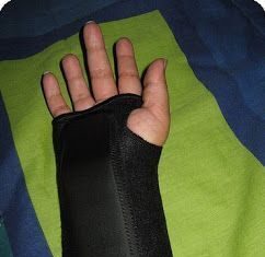 La Tendinitis y su Tratamiento