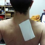 Los Cataplasmas y Emplasto de arcilla